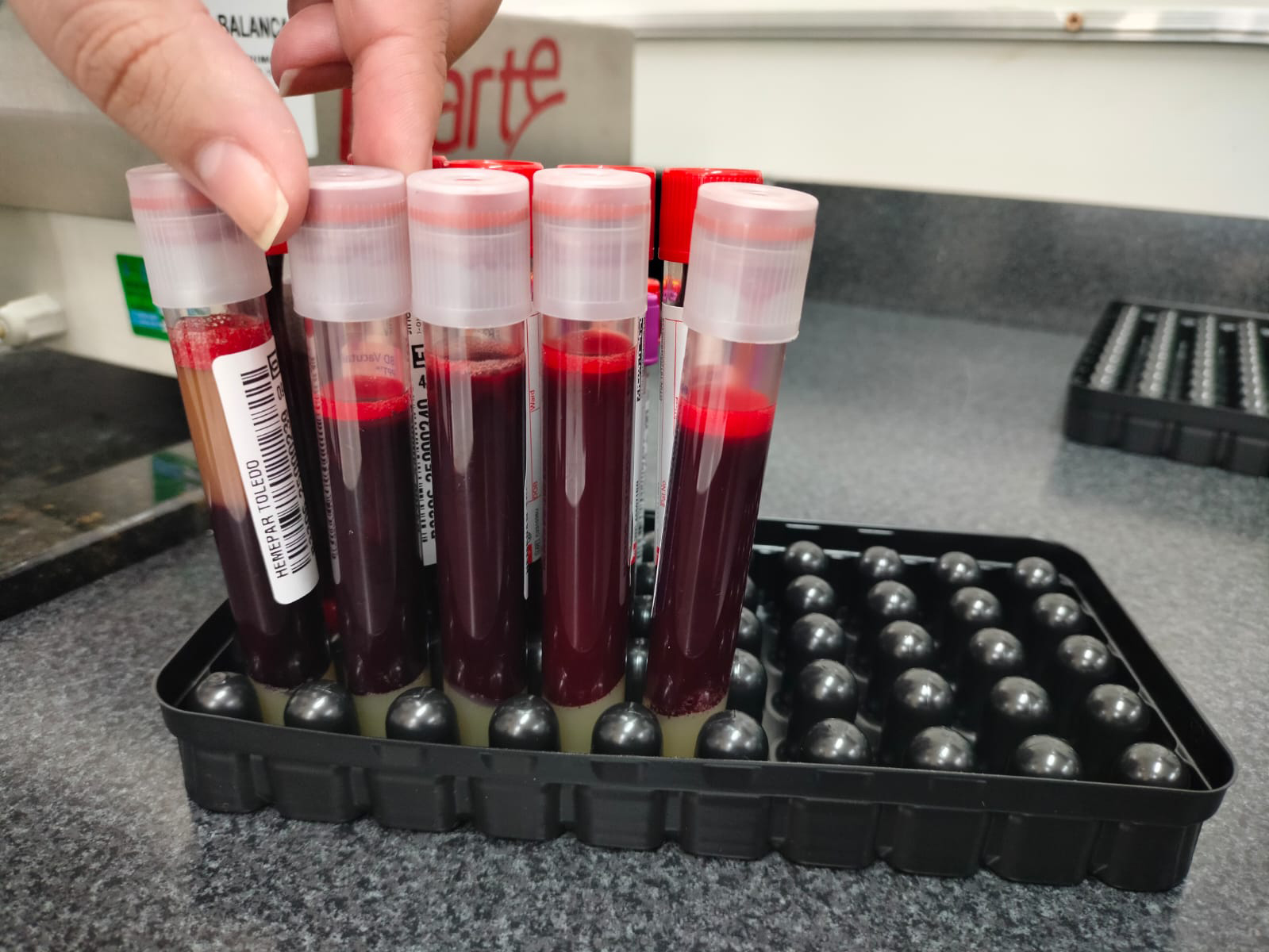 Após o cadastro para doação de medula óssea, é realizada a coleta de sangue para exames Crédito: Arquivo JO