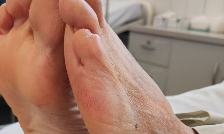 O foco da campanha também é na prevenção de agravos evitáveis, como insuficiência cardíaca, diabetes, hipertensão e outras comorbidades Crédito: Janaí Vieira/Arquivo JO