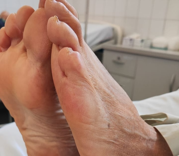 O foco da campanha também é na prevenção de agravos evitáveis, como insuficiência cardíaca, diabetes, hipertensão e outras comorbidades Crédito: Janaí Vieira/Arquivo JO